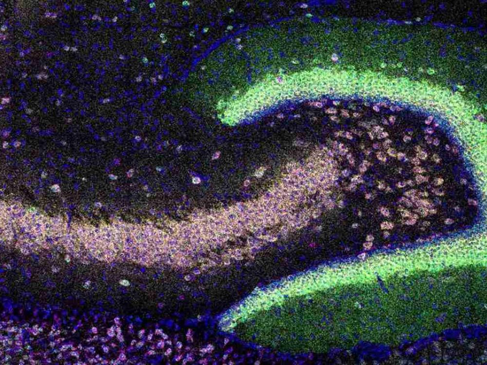 Quattro mRNA localizzati nel neuropilo