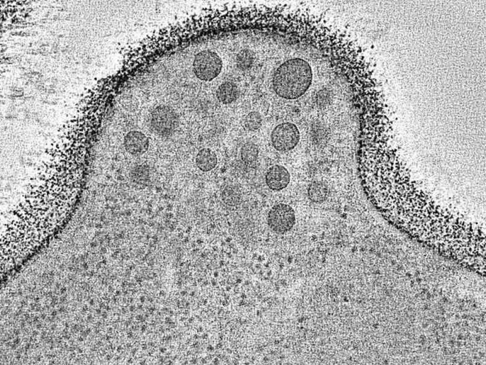 Cellula con più vescicole lipidiche