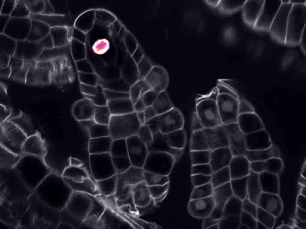 Ovuli di Arabidopsis thaliana