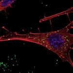  Neuroni GnRH sotto assedio dalle nanoplastiche: l’allarme per la fertilità.