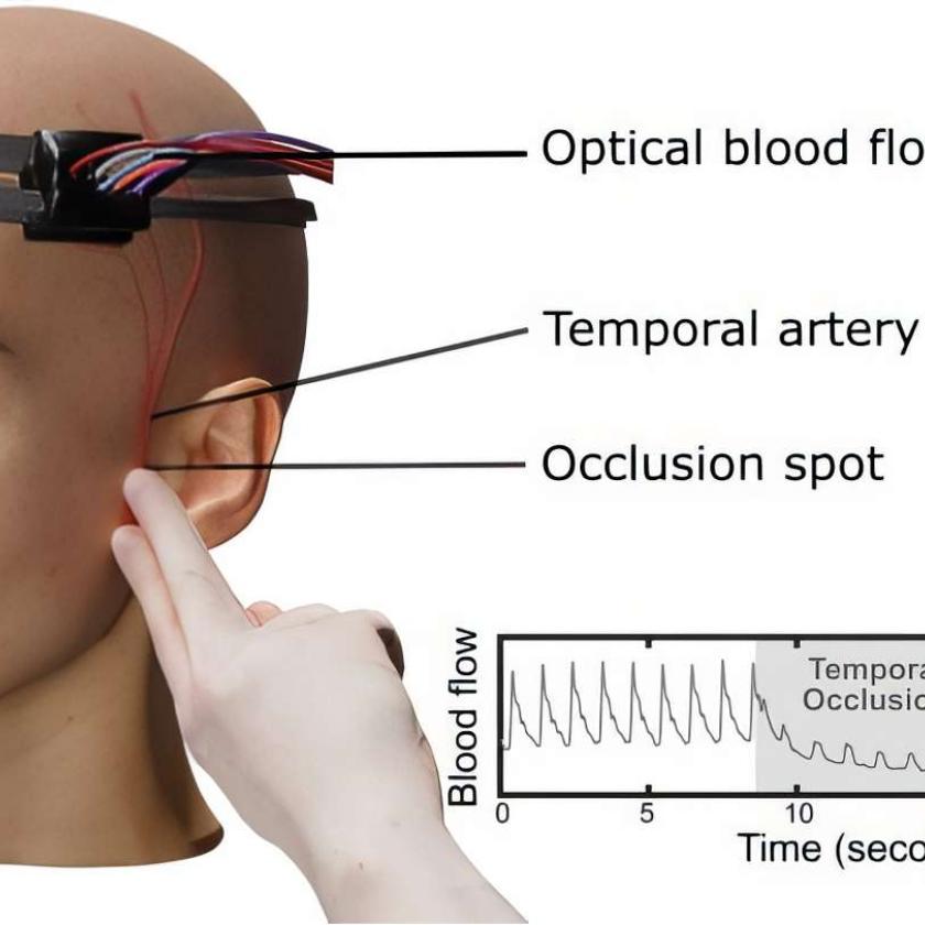 Sistema di spettroscopia ottica