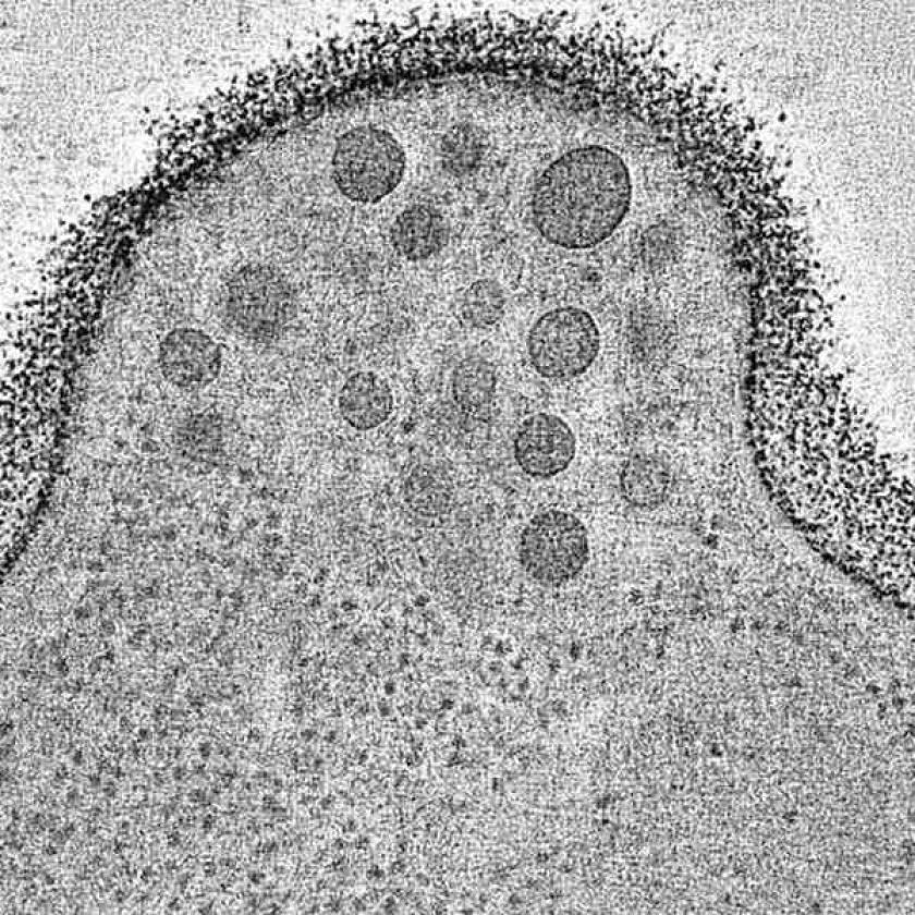 Tomografia di una cellula con più vescicole lipidiche trasportate sulla superficie cellulare.