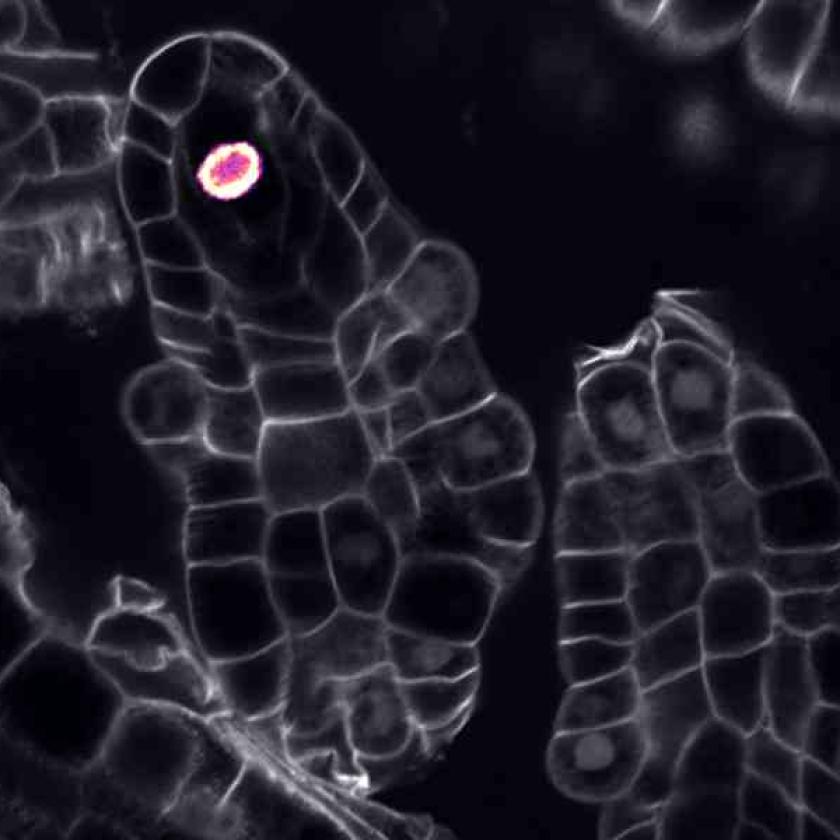 Ovuli di Arabidopsis thaliana